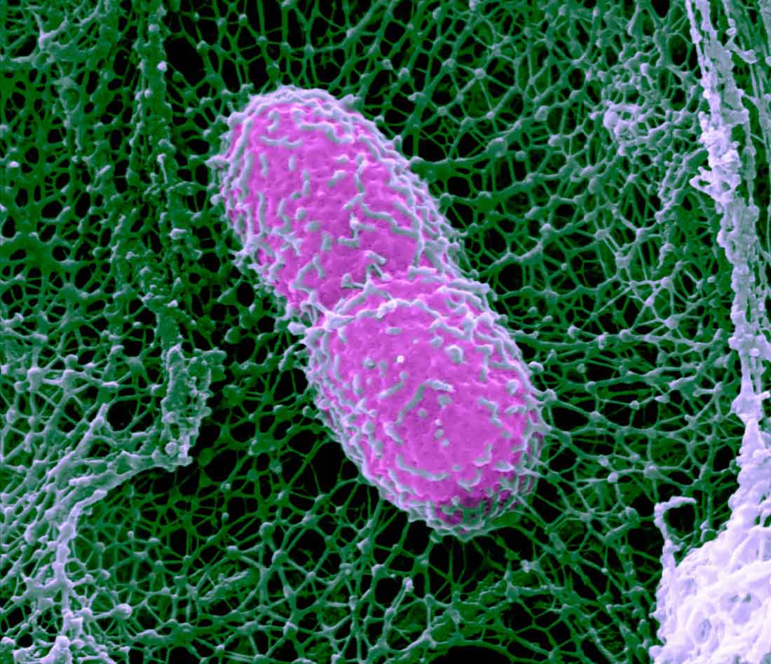 Pneumoniae bacterium in an infected mouse lung